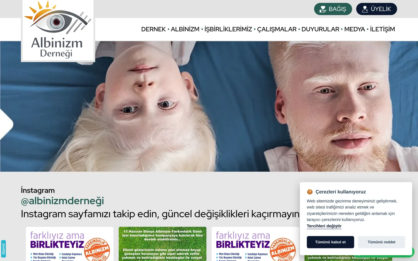 Albinizm Derneği